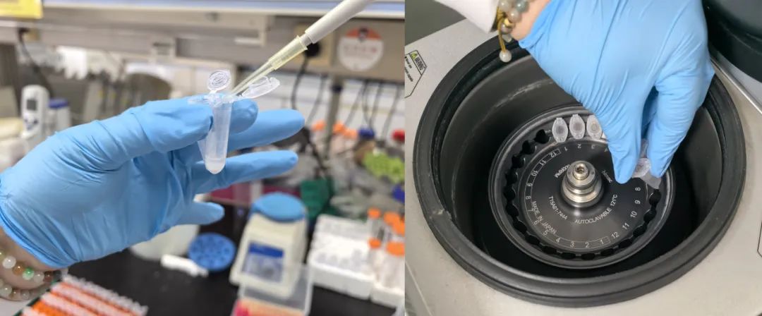 离心浓缩仪在脂质代谢物中的应用